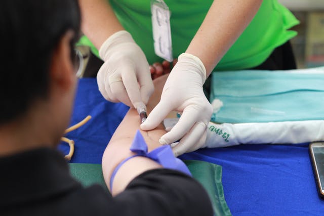 the-magic-of-prp-facial-before-and-after/