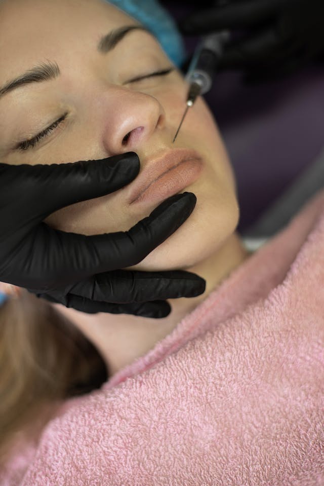Is platelet-rich plasma the secret to younger-looking skin